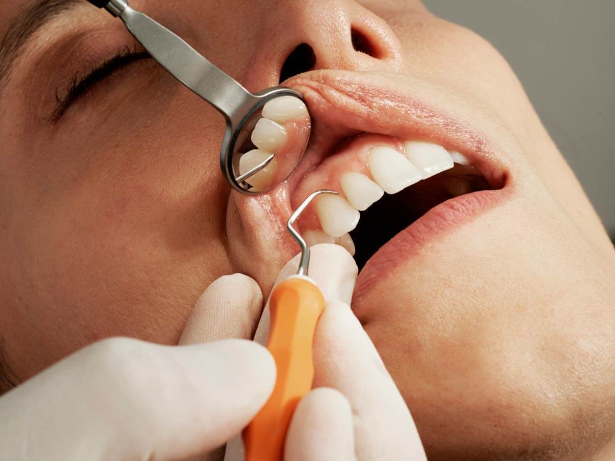 Preventive dental -gum disease identification